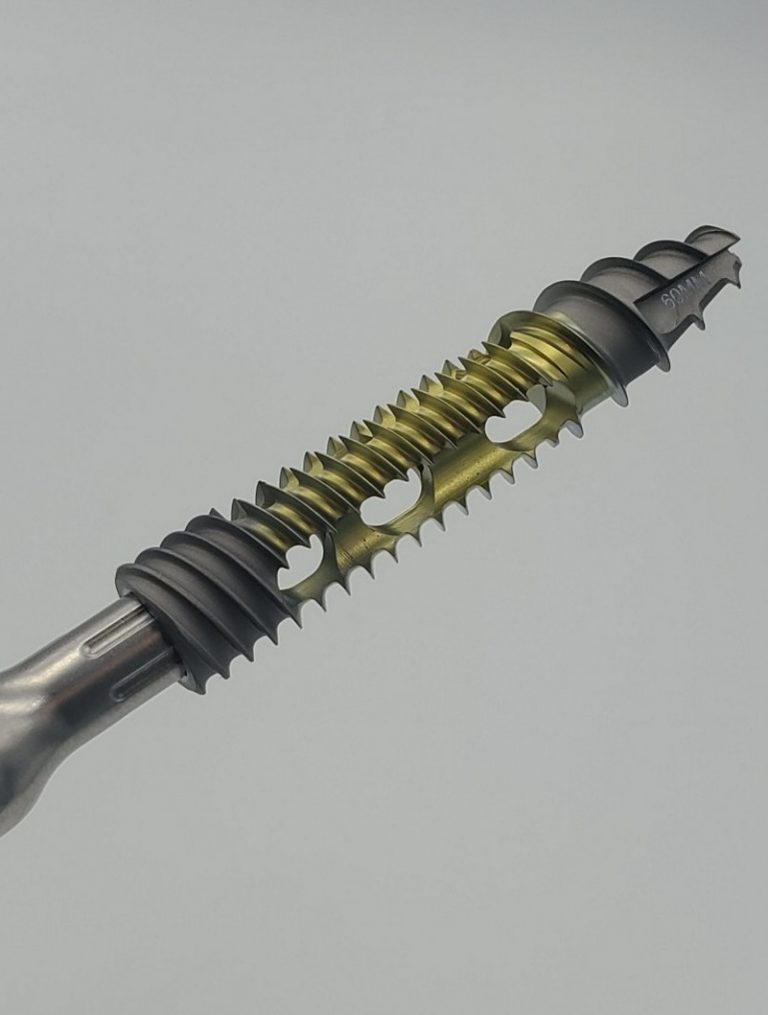 Sacrix LLC is Empowering Physicians to Treat Sacroiliac Joint Pain by Innovative SacroFuse Technology